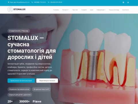 Зображення сайту stomalux.com.ua